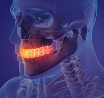 Animation of a painful teeth Image description