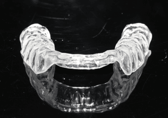 orthotic for tmj pain relief